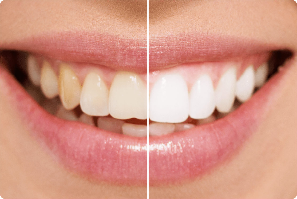 大口あけて笑おう！