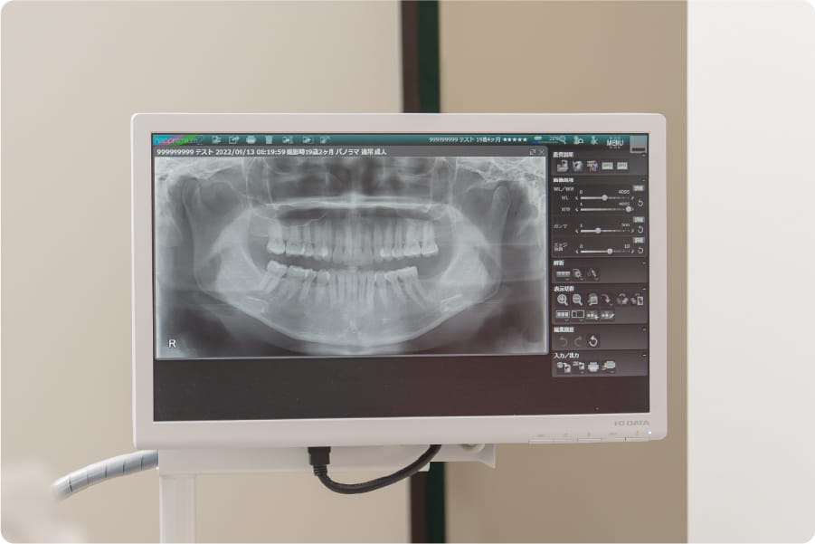 目の前のモニターで<br>お口の状態を確認