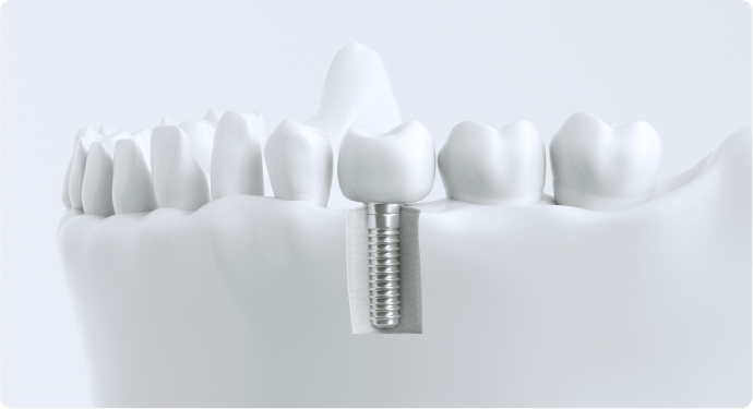 デンタルエステ